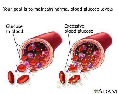 glucose in blood, excessive blood glucose, diabetes